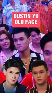 1.8M views · 7.3K reactions | Dustin Yu old face before nagpa-rhinoplasty, ikinagulat ng ibang netizens! #DustinYu #PBBCollab #PBBcollabWithGMA | Deejimon TV | Facebook