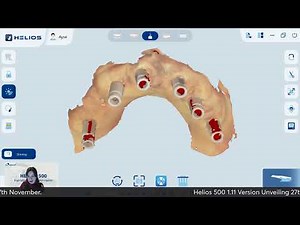 1.11 Version Software Update - Helios 500