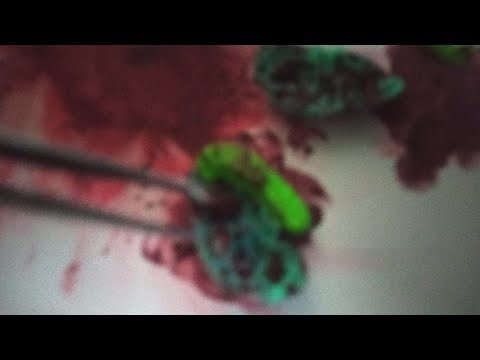 A mini operation :) 10/4/1990