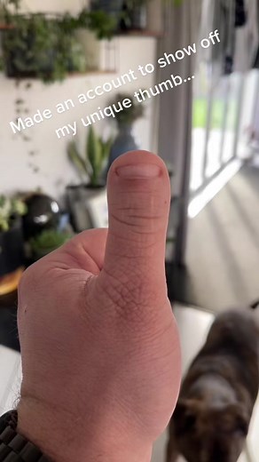 Exploring the World of Unique Thumbs