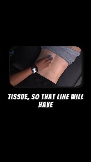 Dynamic Cupping Techniques Explained