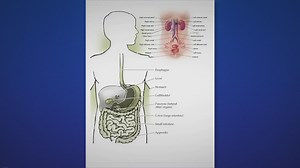 From BRAT to Bananas: Fast Relief and Prevention of Diarrhea through Diet