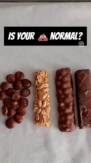 19K views · 20 reactions | A new, tastier Bristol Stool chart  Type 1: Separate hard lumps Type 2: Lumpy and sausage like Type 3: A sausage shape with cracks on the surface Type 4: A smooth, soft, and long sausage shape Type 5: Soft blobs Type 6: Mushy consistency with ragged edges Type 8: Liquid consistency with no solid pieces | Nursing and NCLEX Mastery | Facebook