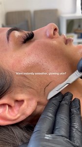 The treatment that gives you INSTANT glow (with zero downtime!) ✨ Dermaplaning is one of my favourite treatments for that immediate skin transformation. If you’ve ever looked in the mirror and wished your skin looked smoother, brighter, and more even, this is your answer! Here’s what dermaplaning really does: ⚡ Removes peach fuzz (vellus hair) for a flawless finish ⚡ Exfoliates dead skin cells to reveal fresh, glowing skin ⚡ Helps skincare absorb deeper & work harder for you ⚡ Creates the perfec