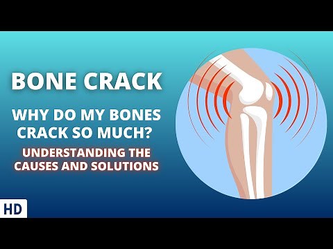 Bone Crack: The Science Behind the Popping Sounds