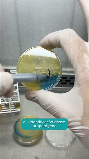 Urine culture: how to perform quantitative seeding for urine culture?