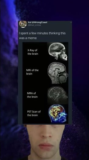Wait For It This Brain Scan Meme Has An Unexpected Twist