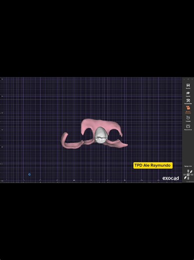 Diseño de Ppr provisional flexibles para fresado en Flexodent PMMA Flex. Amenabar 3D Lab Ar-Tec invent #dentista #exocad #dental #cadcam #tpd