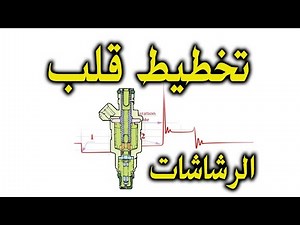 وداعا للتخمين ❌🤔... نعم👍 للتشخيص الاحترافي🙂✅🔧