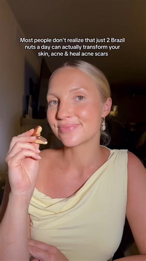 Angelo Landriscina, MD, FAAD on Instagram: "Will Brazil nuts cure your acne?"