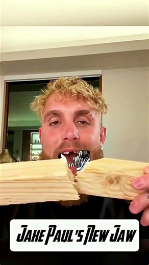 Testing a patient's new titanium jaw