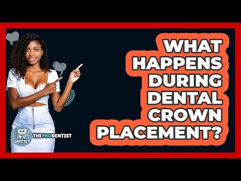 What Happens During Dental Crown Placement?