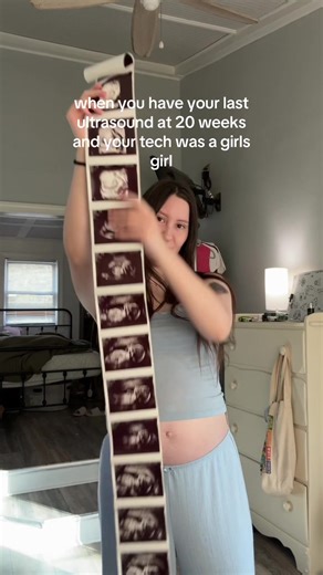 20-Week Ultrasound Joy: Baby Boy Reveal 🥹🥰