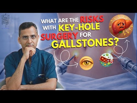 What are the risks with keyhole surgery for gallstones?