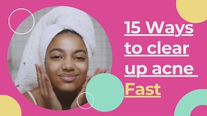 15 Ways to clear up acne fast