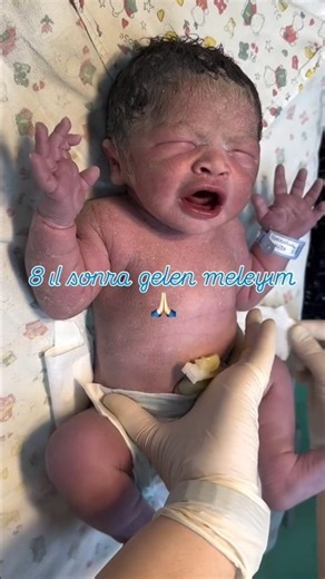 From Pain to Pure Magic The Beautiful Journey of Birthing Twins👶💞 #Shorts #ViralMoments #Motherhood