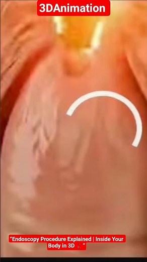 “Endoscopy Explained in 3D | How Doctors Examine Your Stomach Safely | Full Medical Animation Guide”