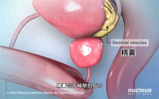 男人不要纵欲过度，前列腺增生的病因和治疗，3D演示。。