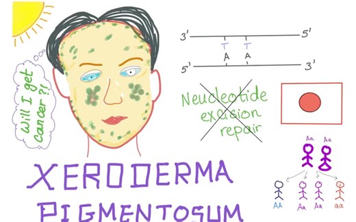 Xeroderma Pigmentosum