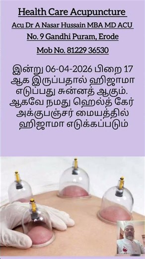 Hijama #Health #cupping therapy #Care #இரத்தம் தூய்மை பெற #Acupuncture #blood circulation #treatment