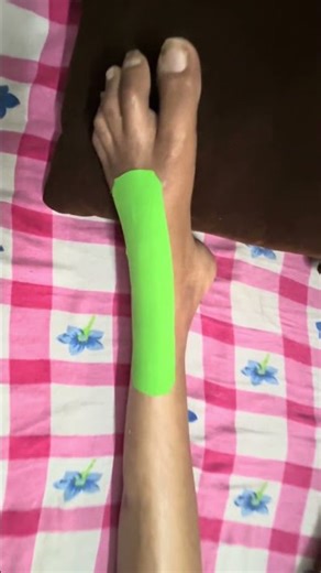 Walking Again After Paraplegia Surgery | Rehab Journey