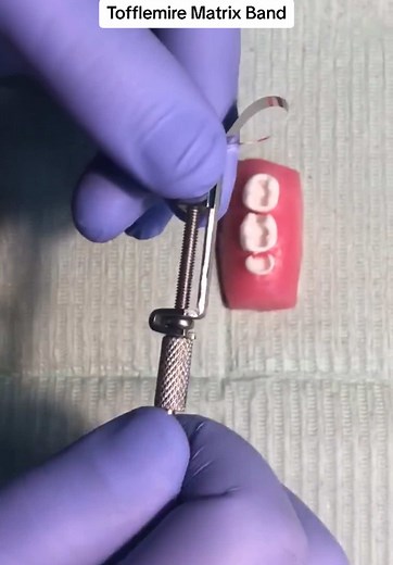 Using the Tofflemire Matrix Band and Holder Like a Pro