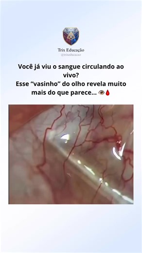 Trix Educação on Instagram: "E aí você já tinha visto? Deixa aqui nos comentários 👇🏻 Créditos: Internet/ Instagram #trixeducacao #EstudantesDeEnfermagem #curiosidades #nutricionista #farmácia #faculdade #instagram #anatomia #biomedicina #medicina"