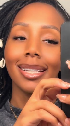 Blinged Out Retainers with Gems: DIY Tutorial