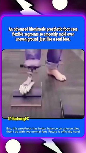 The Prosthetic That's More Human Than Robot 🤯