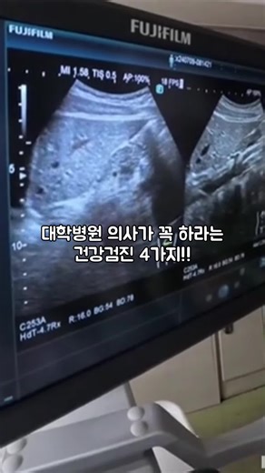 대학병원 의사가 추천하는 건강검진 4가지