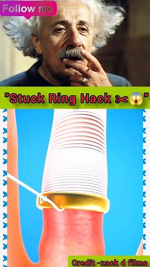 3.1K views | Ever had a ring stuck on your finger?  Don’t panic — this simple life hack will help you remove it safely without pain or tools! ✂️ Watch till the end — the trick is genius   #LifeHack #SmartTrick #DIYTips #RingHack #SmartShock #reelschallengereelschallengereelschallengereelschallenge | SmartShock | Facebook