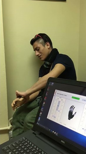 Myoelectric Prosthetic Hand