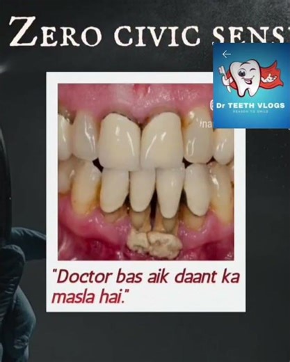 Zero Civics Sense#viral #trendingshorts #pyria #teethcare #world #meme #reels #health #comedy #jokes