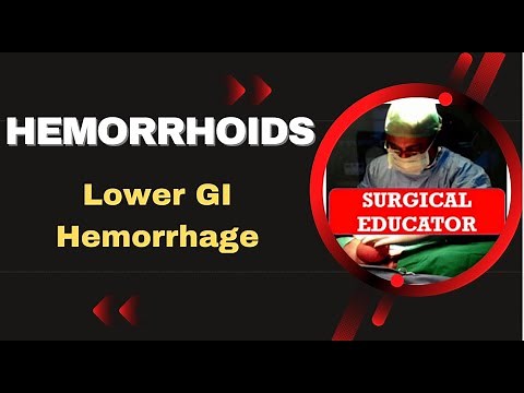 HEMORRHOIDS- How To DIAGNOSE & TREAT/ Lower GI Hemorrhage