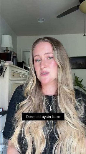 Your ovary can grow hair, skin… even teeth.