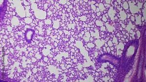 Thinnest section of a human lung under a microscope. Bright-field optical microscopy. 100x times magnification. Internal structure of the lung. Alveoli, bronchi, vessels etc.