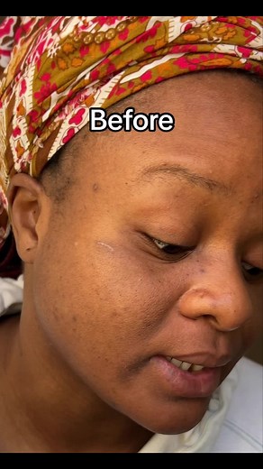 Gentle Magic Skincare Update & Review