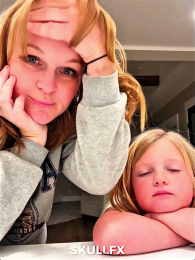 Biggest Forehead Trend😂😯 #trolledit #troll #trolllife #edit