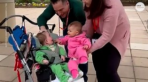 Twins meet for first time after birth defect kept them apart for year