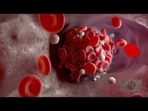 Doctor Explains: How VEGF Causes Vision Changes and Eye Damage | Barakah Care Compass