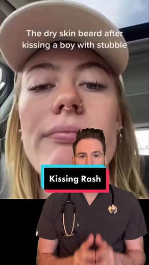 Kissing rashes can quickly turn into the infection impetigo. #impetigo #rash #firstkiss #doctor