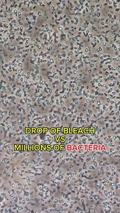 8.5K views · 1.3K reactions | #microscope #interesting #bleach #bacteria | Microworld Discovery | Facebook