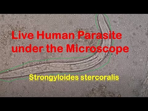 Human Parasites Live under the Microscope || Strongyloides stercoralis
