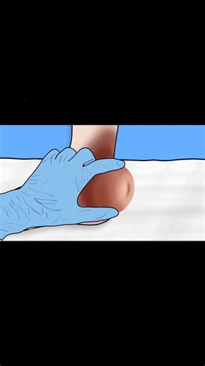 @asmr_doctor_2 on Instagram: "ASMR Leg Foot 👣 Piercing Cleaning Treatment Animation #asmr #animation #satisfying #trending #viral"
