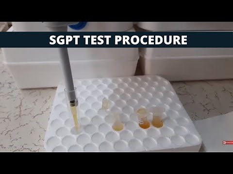 SGPT Test Procedure | SGPT Simple Test Procedure