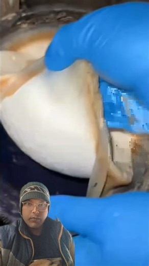 Tree Sap That Becomes Tires & Gloves