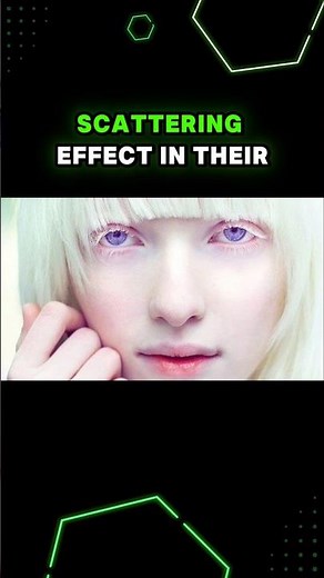 Red and Violet Eyes from Albinism!