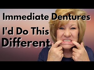 Immediate Dentures After A Full Mouth Extraction / What I Would CHANGE