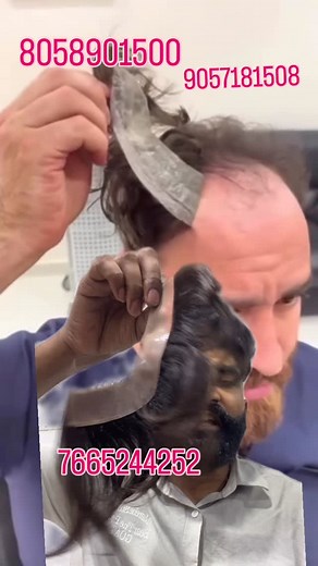 Boost your wig shop and Hair fixing center sales with 100% natural human hair wigs directly from our manufacturing factory. Shabnam scissors looks. 7665244252. specializes in men’s & women’s wigs, crafted for durability and comfort. We already supply across India with fast delivery and competitive bulk pricing. Competitive wholesale prices J Direct-from-factory supply J Premium 100% human hair quality Partner with a trusted Chinese manufacturer based in Bangladesh and give your clients the natur