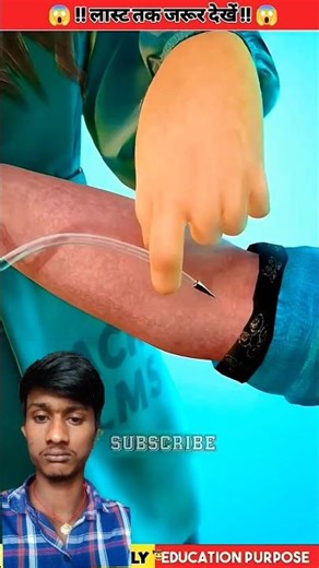 What If Sheep Blood Was Transfused Into a Human? 😳🧬 (Unbelievable Facts)